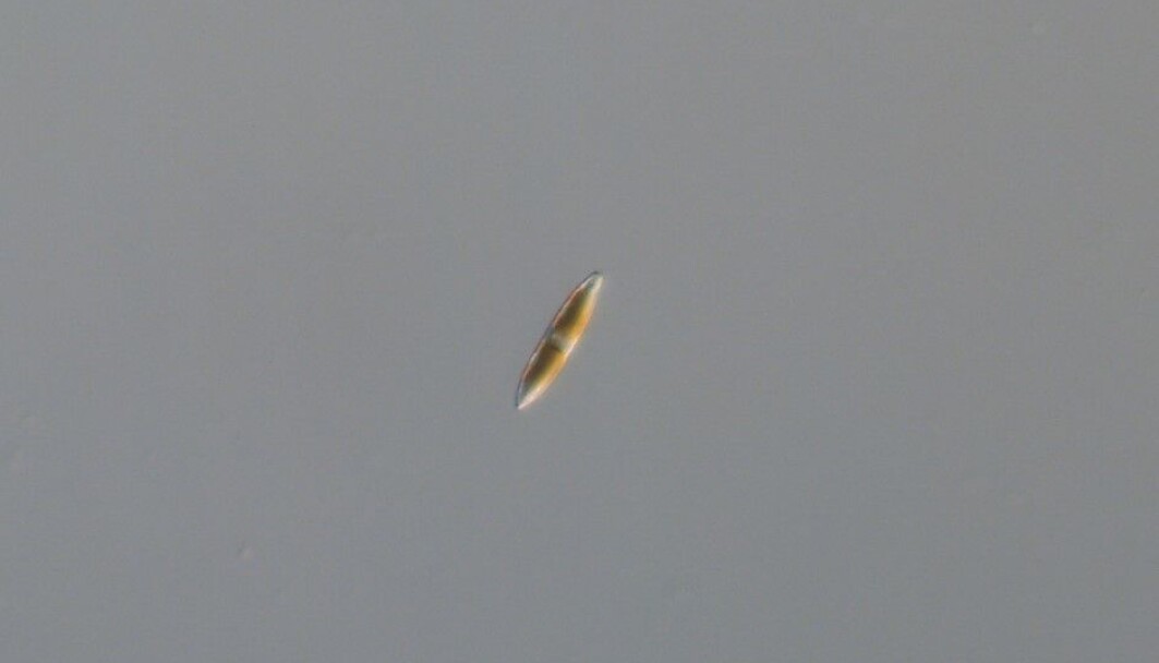 En liten og ukjent kiselalge fra en smeltedam. Hva kan den fortelle oss om framtiden til Arktis? (Denne ukjente algen tilhører mest sannsynligvis en gruppe kiselalger som kalles Nitzschia). En liten og ukjent kiselalge fra en smeltedam. Hva kan den fortelle oss om framtiden til Arktis? (Denne ukjente algen tilhører mest sannsynligvis en gruppe kiselalger som kalles Nitzschia).
