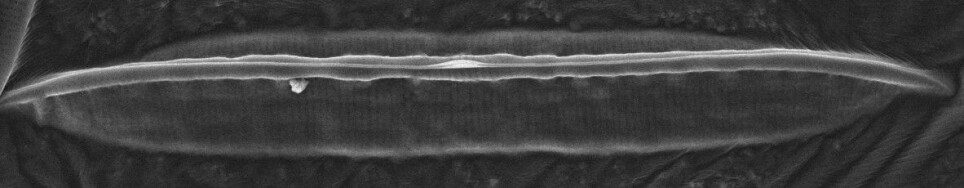 Et elektronmikroskopi bilde av utsiden av lokke. Den leppeformete strukturen som går på tvers av utsiden i midten kalles rafe, og er viktig for algen til å kunne bevege seg i habitatet.