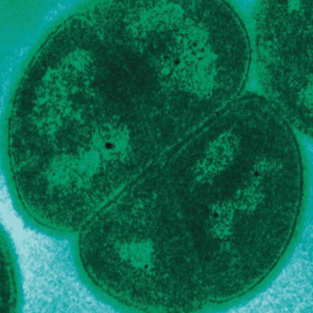 Deinococcus radiodurans. (Bilde: Wikimedia Commons, se lisens her) Deinococcus radiodurans. (Bilde: Wikimedia Commons, se lisens her)