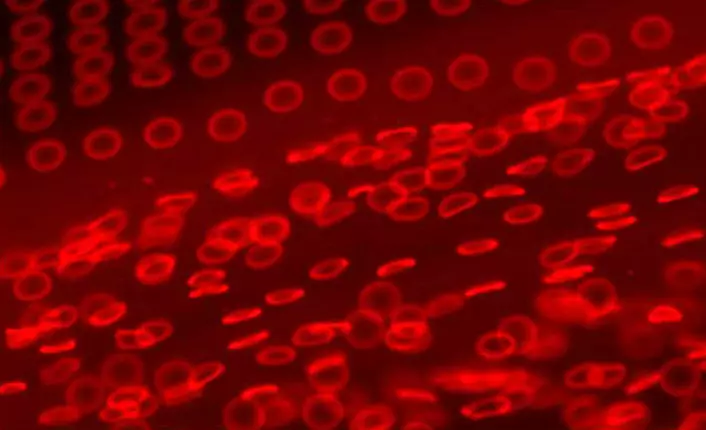 Elastiske hydrogel-partikler som etterligner røde blodlegemer. (Foto: Timothy J. Merkel og Joseph M. DeSimone, University of North Carolina at Chapel Hill)