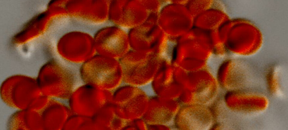 Fleksible hydrogel-partikler som etterligner røde blodlegemer. (Foto: Timothy J. Merkel og Joseph M. DeSimone, University of North Carolina at Chapel Hill)
