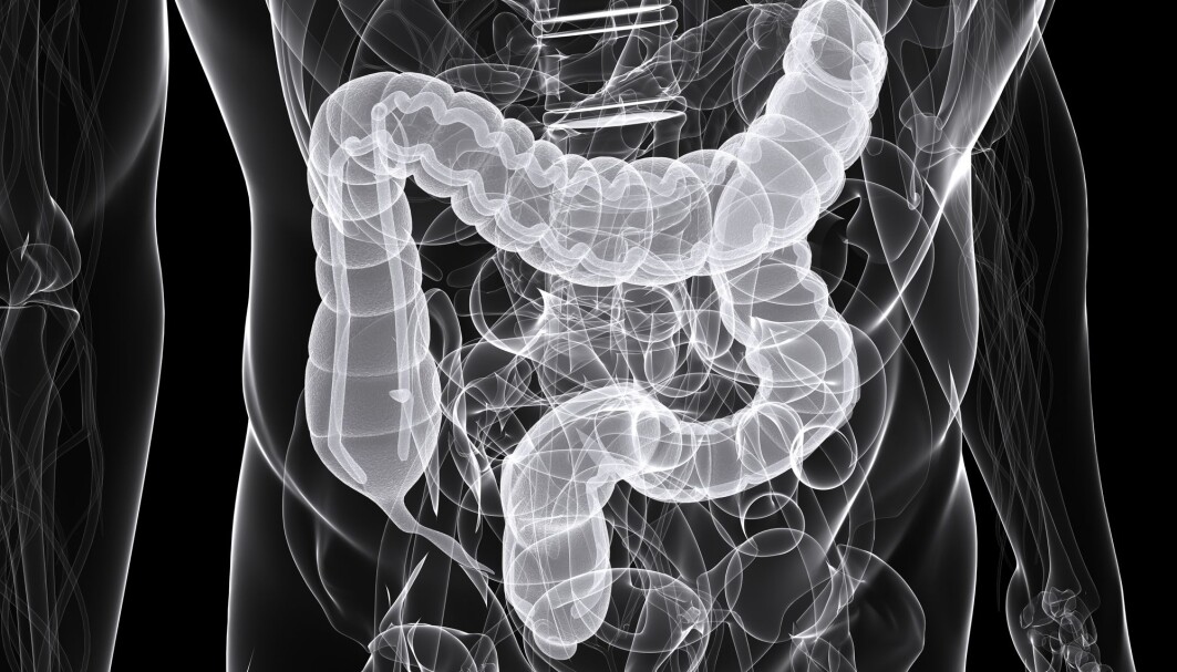 Forskere fant at antibiotika ga økt risiko for kreft i den første delen av tykktarmen (som går loddrett) og den neste delen (som går horisontalt), men ikke i resten av tarmen. Forskere fant at antibiotika ga økt risiko for kreft i den første delen av tykktarmen (som går loddrett) og den neste delen (som går horisontalt), men ikke i resten av tarmen.