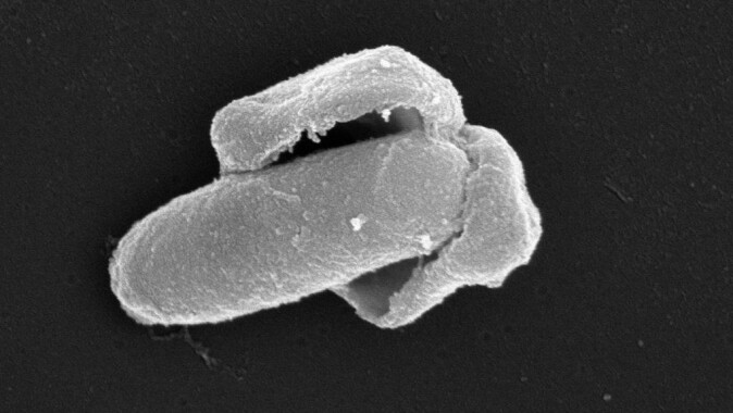 Her ser vi en <span class=" italic" data-lab-italic_desktop="italic">Bacillus licheniformis</span>-spore som våkner til live; sporeskallet sprekker og en voksende bakterie kommer ut. Her ser vi en <span class=" italic" data-lab-italic_desktop="italic">Bacillus licheniformis</span>-spore som våkner til live; sporeskallet sprekker og en voksende bakterie kommer ut.