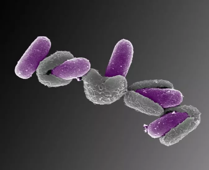 Dette bildet viser flere <span class=" italic" data-lab-italic_desktop="italic">Bacillus licheniformis</span>-sporer som våkner. Bakteriene er fargelagt lilla på bildet for å tydeliggjøre prosessen.