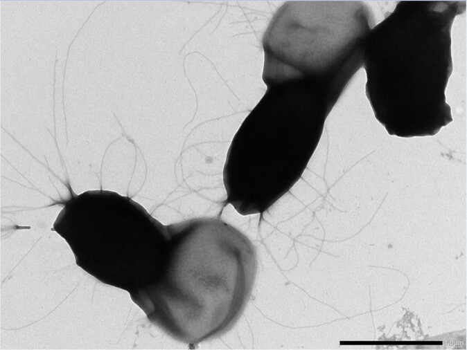 Bacillus cereus-sporer er problematiske for meieri-industrien siden de overlever varmebehandling og binder seg til rørsystemer og utstyr. Forskerne tror de lange trådene på sporeoverflaten hjelper sporene å feste seg til rustfritt stål og danne grunnlag for biofilm. Bacillus cereus-sporer er problematiske for meieri-industrien siden de overlever varmebehandling og binder seg til rørsystemer og utstyr. Forskerne tror de lange trådene på sporeoverflaten hjelper sporene å feste seg til rustfritt stål og danne grunnlag for biofilm.