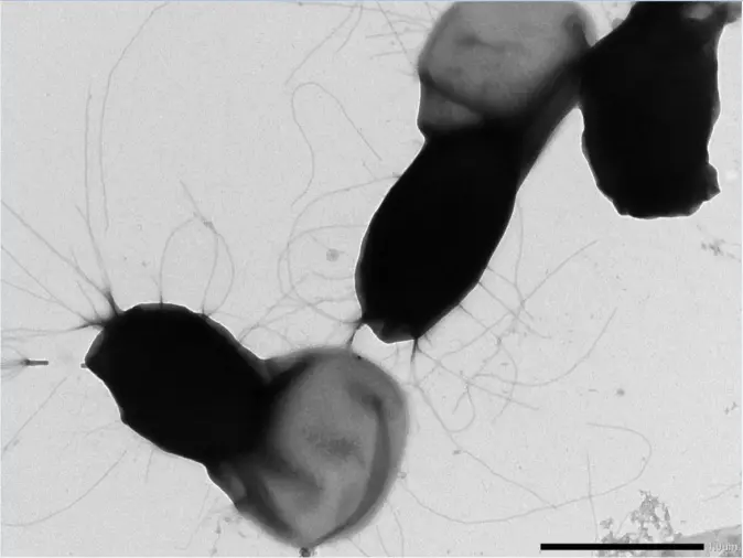 Bacillus cereus-sporer er problematiske for meieri-industrien siden de overlever varmebehandling og binder seg til rørsystemer og utstyr. Forskerne tror de lange trådene på sporeoverflaten hjelper sporene å feste seg til rustfritt stål og danne grunnlag for biofilm. Bacillus cereus-sporer er problematiske for meieri-industrien siden de overlever varmebehandling og binder seg til rørsystemer og utstyr. Forskerne tror de lange trådene på sporeoverflaten hjelper sporene å feste seg til rustfritt stål og danne grunnlag for biofilm.