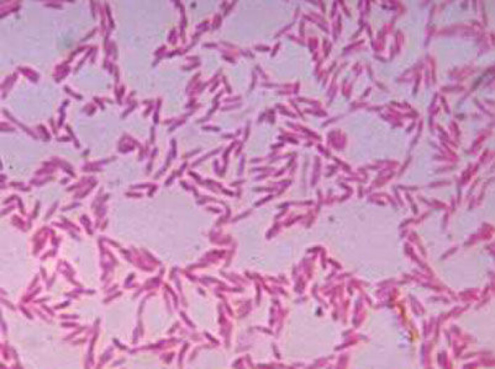 (Foto: Center for Disease Control and Prevention, Dr. V.R. Dowell, Jr.) (Foto: Center for Disease Control and Prevention, Dr. V.R. Dowell, Jr.)