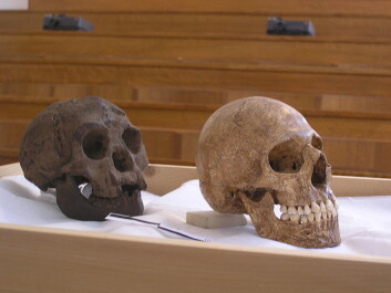 "Avstøpning av skallen til Homo floresiensis (t.v.) sammen med moderne menneske med mikrocephali, hjerne med dvergvekst. Brukt for å understøtte teorien om at Flores-mennesket hadde sykelig dvergvekst. (Foto: Avandergeer, Creative Commons)" "Avstøpning av skallen til Homo floresiensis (t.v.) sammen med moderne menneske med mikrocephali, hjerne med dvergvekst. Brukt for å understøtte teorien om at Flores-mennesket hadde sykelig dvergvekst. (Foto: Avandergeer, Creative Commons)"