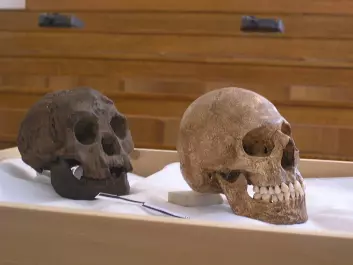 "Avstøpning av skallen til Homo floresiensis (t.v.) sammen med moderne menneske med mikrocephali, hjerne med dvergvekst. Brukt for å understøtte teorien om at Flores-mennesket hadde sykelig dvergvekst. (Foto: Avandergeer, Creative Commons)"