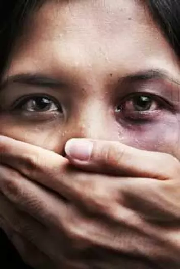 I saker med påstått mishandling og vold er det viktig med objektive undersøkelsesmetoder. (Foto: Shutterstock)