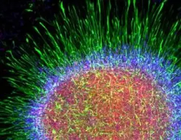 Uutviklete astrocytter og opphavs-celler klumper seg sammen og former en "stjernehop".( Foto: Robert Krencik/ UW-Madison)