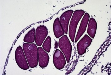 Tverrsnitt av en Lophelia pertusa korallhunn (forstørret 100 ganger) som viser modne egg. Tverrsnitt av en Lophelia pertusa korallhunn (forstørret 100 ganger) som viser modne egg.