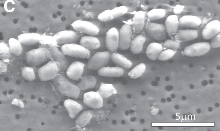 Bilde i elektronmikroskop av bakterien GFAJ-1. (Foto: Science/AAAS) Bilde i elektronmikroskop av bakterien GFAJ-1. (Foto: Science/AAAS)