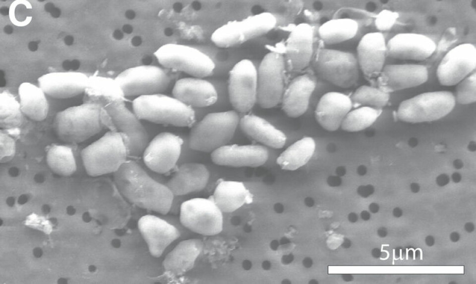 Bilde i elektronmikroskop av bakterien GFAJ-1. (Foto: Science/AAAS)