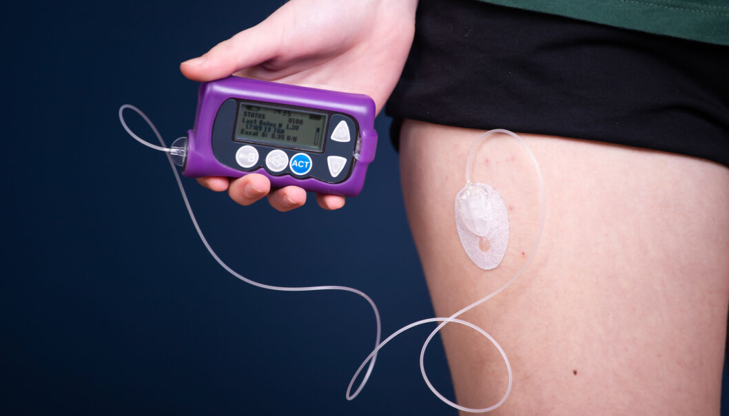 Diabetes type 1 er en autoimmun sykdom som skyldes at immunsystemet angriper og ødelegger de insulinproduserende cellene i bukspyttkjertelen. En person som får diabetes 1 må tilføre insulin, for eksempel ved hjelp av en slik insulinpumpe. Diabetes type 1 er en autoimmun sykdom som skyldes at immunsystemet angriper og ødelegger de insulinproduserende cellene i bukspyttkjertelen. En person som får diabetes 1 må tilføre insulin, for eksempel ved hjelp av en slik insulinpumpe.