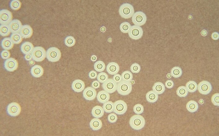 "Dette er muggsoppen Cryptococcus neoformans. Tidligere ble Cryptococcus gattii kalt en variant av denne. Nå er den regnet som en nær slektning. (Foto: Wikimedia Commons)" "Dette er muggsoppen Cryptococcus neoformans. Tidligere ble Cryptococcus gattii kalt en variant av denne. Nå er den regnet som en nær slektning. (Foto: Wikimedia Commons)"