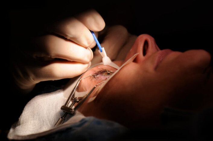 "Kvinne som får utført laseroperasjon av typen LASIK. (Foto: Istockphoto)" "Kvinne som får utført laseroperasjon av typen LASIK. (Foto: Istockphoto)"