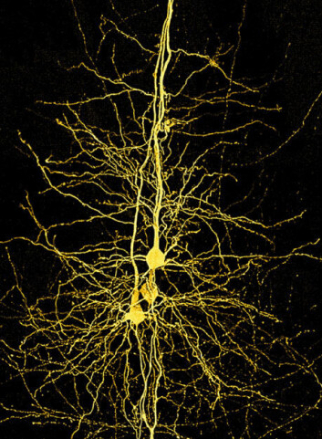 "Tre hjerneceller som er knyttet tett sammen med nervetråder for å utveksle informasjon før de sender informasjonen ut fra neocortex. (Bilde: Brain Mind Institute, Ecole Polytechnique Fedreal de Lausanne)" "Tre hjerneceller som er knyttet tett sammen med nervetråder for å utveksle informasjon før de sender informasjonen ut fra neocortex. (Bilde: Brain Mind Institute, Ecole Polytechnique Fedreal de Lausanne)"