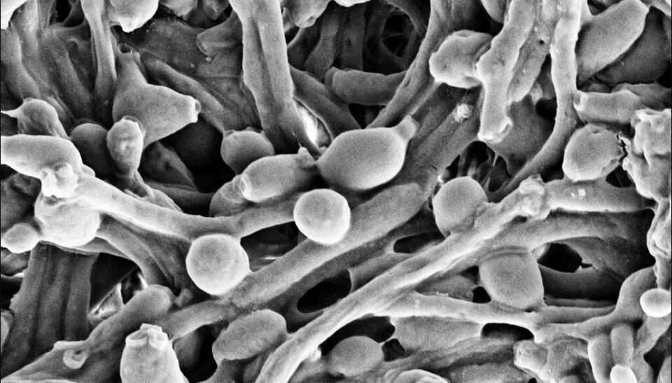 Gjærsoppen Candida albicans ser slik ut under et elektronmikroskop. I kroppen til mus kan den stimulere det medfødte immunsystemet, og skape en økt beskyttelse mot andre sykdommer. Denne egenskapen kan til og med arves.