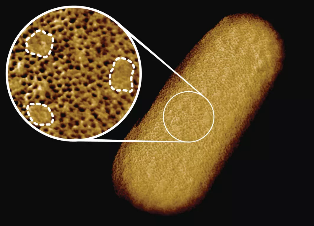Verdens skarpeste foto av en bakterie! Eller, kanskje ikke helt et foto. Det går ikke an å bruke fotoapparat for å lage et slikt bilde. I stedet førte forskerne en bitte, bitte liten nål fram og tilbake over bakterien. På den måten følte de seg fram til hvordan overflata ser ut.