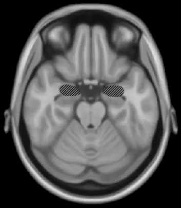 "Bildet viser hvor amygdala ligger i hjernen - i de grå skraverte feltene. (Illustrasjon: Wikimedia Commons/Woutergroen)",big=large