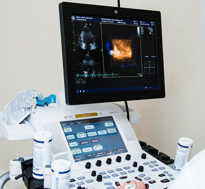 The image shows an echocardiographic examination of a patient's heart at Oslo University Hospital. The image shows an echocardiographic examination of a patient's heart at Oslo University Hospital.