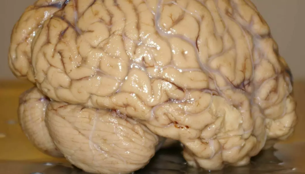 Hjernedop skaper hodebry