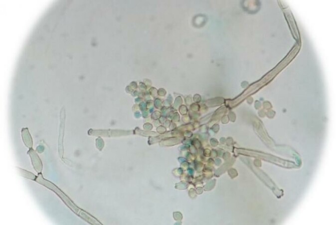 Sopp av typen <span class=" italic" data-lab-italic_desktop="italic">Cladosporium</span>. Sopp av typen <span class=" italic" data-lab-italic_desktop="italic">Cladosporium</span>.