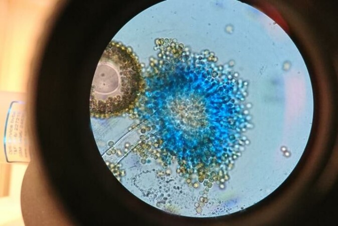 Muggsopp fra slekten <span class=" italic" data-lab-italic_desktop="italic">Aspergillus</span>, en av soppene som er knyttet til menneskelig aktivitet. Muggsopp fra slekten <span class=" italic" data-lab-italic_desktop="italic">Aspergillus</span>, en av soppene som er knyttet til menneskelig aktivitet.