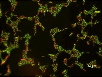 "En forstørrelse av E. coli som er blitt eksponert for en lav konsentrasjon av nanopartikler av stoffet titaniumoksid. Cellene med påvirkede membraner er her farget røde. (Kilde: University of Toledo)" "En forstørrelse av E. coli som er blitt eksponert for en lav konsentrasjon av nanopartikler av stoffet titaniumoksid. Cellene med påvirkede membraner er her farget røde. (Kilde: University of Toledo)"