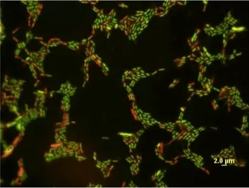 "En forstørrelse av E. coli som er blitt eksponert for en lav konsentrasjon av nanopartikler av stoffet titaniumoksid. Cellene med påvirkede membraner er her farget røde. (Kilde: University of Toledo)"