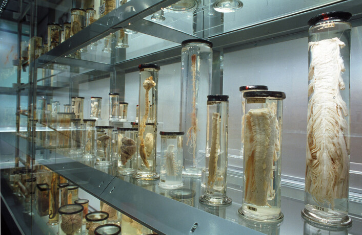 Ulike deler av kroppen er skilt ut i ulike krukker. Her er avdelinga for blant annet hjerner og ryggmarg fra ulike arter. (© The Hunterian Museum at The Royal College of Surgeons) Ulike deler av kroppen er skilt ut i ulike krukker. Her er avdelinga for blant annet hjerner og ryggmarg fra ulike arter. (© The Hunterian Museum at The Royal College of Surgeons)