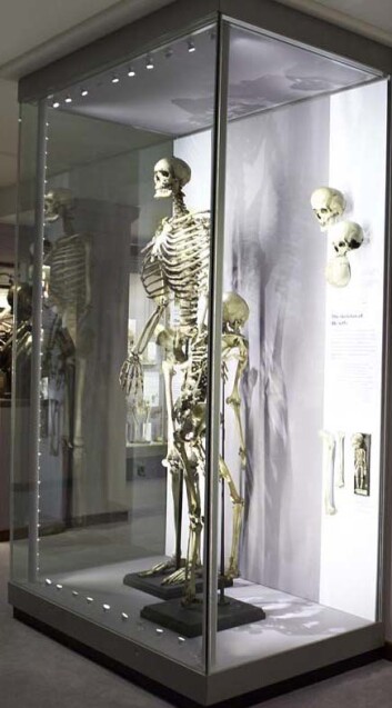 Den 2,50 meter høye irske kjempen Charles Byrne ville slett ikke havne i klørne på kirurger som lurte på hvordan han så ut inni. Men slik gikk det likevel. (© The Hunterian Museum at The Royal College of Surgeons) Den 2,50 meter høye irske kjempen Charles Byrne ville slett ikke havne i klørne på kirurger som lurte på hvordan han så ut inni. Men slik gikk det likevel. (© The Hunterian Museum at The Royal College of Surgeons)