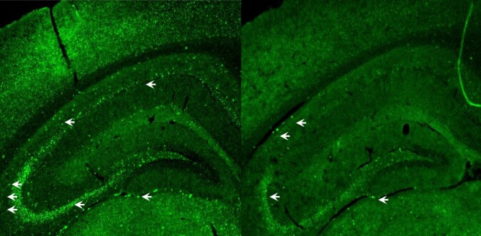 Venstre side: De skarpt grønne feltene, markert med hvite piler, er avfall i en hjernecelle. Til høyre ser vi hvordan stoffet rhapontigenin har redusert mengden avfall.