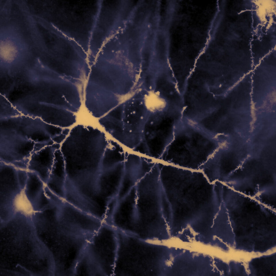 Neuroner i menneskehjerne (Illustrasjonsfoto: MethoxyRoxy, se lisens)
