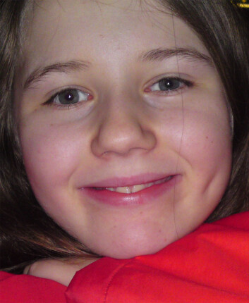Bjørg med sitt ene smilehull (Foto: privat) Bjørg med sitt ene smilehull (Foto: privat)