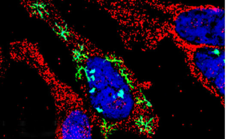 Her er en menneskecelle studert i mikroskop (immunofluorescensmikroskopi). Cellekjernen er blå, de muterte Huntingtinene er grønne, mens komponenter av Nat-A-komplekset er i rødt. (Foto: Kristian Starheim)