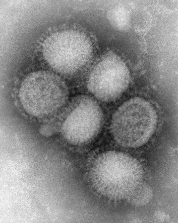 Her ser du viruspartikler av det fryktede svineviruset. (Foto: C. S. Goldsmith and A. Balish, CDC) Her ser du viruspartikler av det fryktede svineviruset. (Foto: C. S. Goldsmith and A. Balish, CDC)