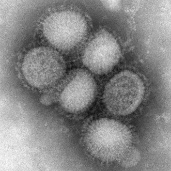 Her ser du viruspartikler av det fryktede svineviruset. (Foto: C. S. Goldsmith and A. Balish, CDC) Her ser du viruspartikler av det fryktede svineviruset. (Foto: C. S. Goldsmith and A. Balish, CDC)