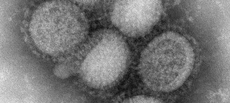 Her ser du viruspartikler av det fryktede svineviruset. (Foto: C. S. Goldsmith and A. Balish, CDC)