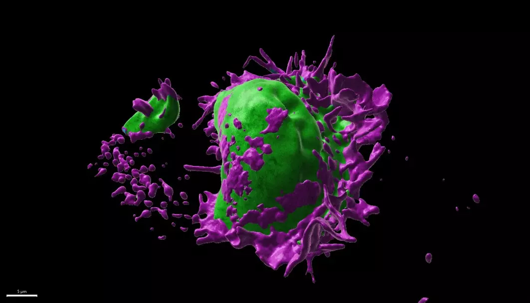 Bildet viser kreftcellens cellemembran (grønn) som bruker fangarmer (lilla) til å slurpe i seg næringsrike kroppsvæsker utenfor kreftcellen.