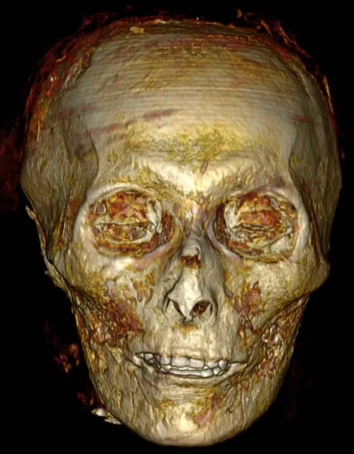 Denne mannen ble begravet første gang for 3400 år siden. Både hodeskallen og tennene er godt bevarte.