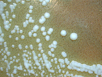 Laboratoriekoloni av Francisella-bakterier. (Foto: Larry Stauffer) Laboratoriekoloni av Francisella-bakterier. (Foto: Larry Stauffer)