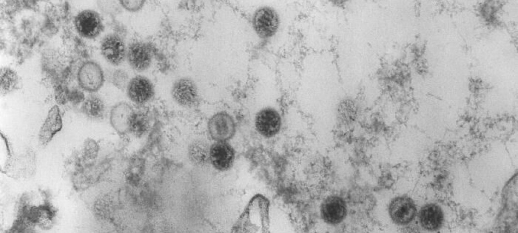 Ny studie: Kyssesykevirus ser ut til å være hoved­årsaken til MS
