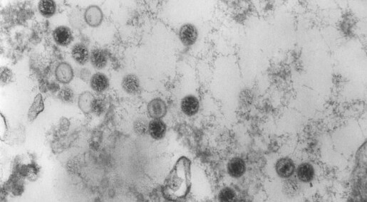 Ny studie: Kyssesykevirus ser ut til å være hovedårsaken til MS Ny studie: Kyssesykevirus ser ut til å være hovedårsaken til MS