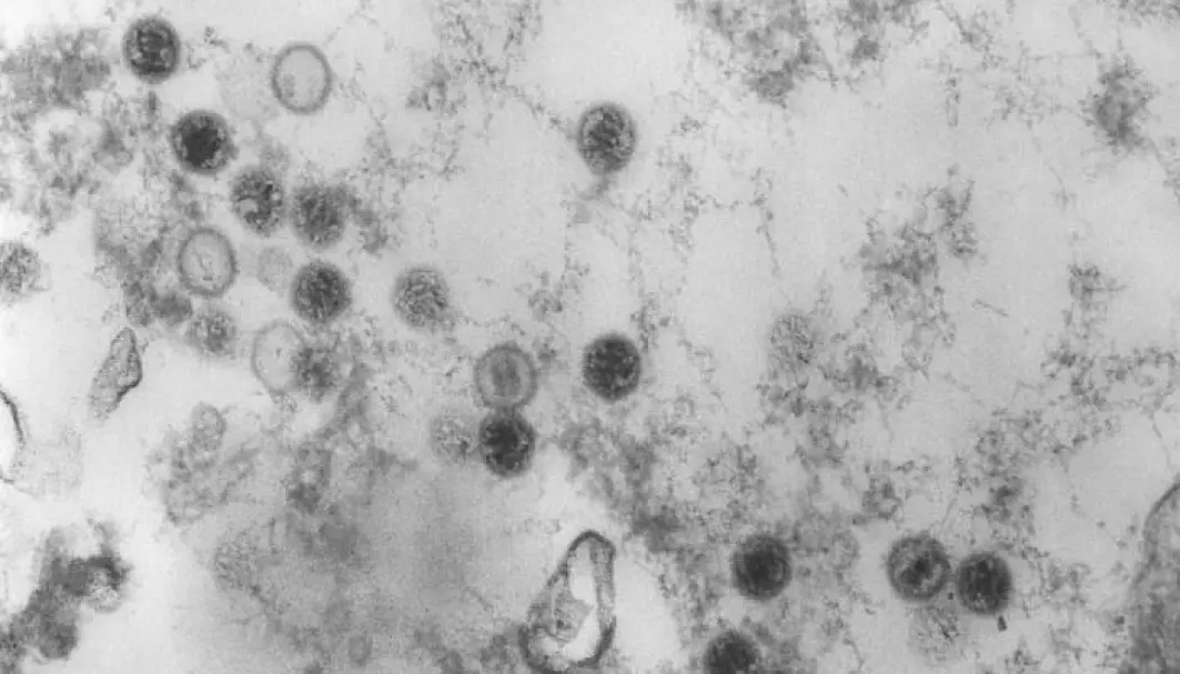 Bildet viser flere Epstein-Barr virus, her studert med elektronmikroskop.