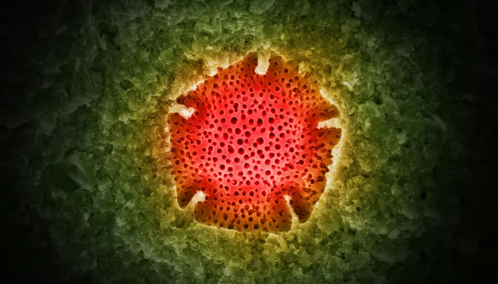Kunstig farget elektronmikroskopbilde av et pollen-korn.