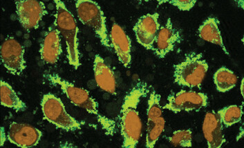 Her er såkalte nanodiamanter (i lysende grønt) på vei til å ta over kreftceller. På dette motivet er de ørsmå karbonpartiklene tilsatt et lysutsendende stoff. (Foto: © Science/AAAS) Her er såkalte nanodiamanter (i lysende grønt) på vei til å ta over kreftceller. På dette motivet er de ørsmå karbonpartiklene tilsatt et lysutsendende stoff. (Foto: © Science/AAAS)