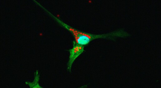 Følger stamceller i hjernen
