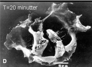 "En kreftcelle slik den ser ut 20 minutter etter at antimikrobielle peptider har laget hull i cellehinnen, og nærmest sprengt den i filler. (Foto: Lytix Biopharma)" "En kreftcelle slik den ser ut 20 minutter etter at antimikrobielle peptider har laget hull i cellehinnen, og nærmest sprengt den i filler. (Foto: Lytix Biopharma)"